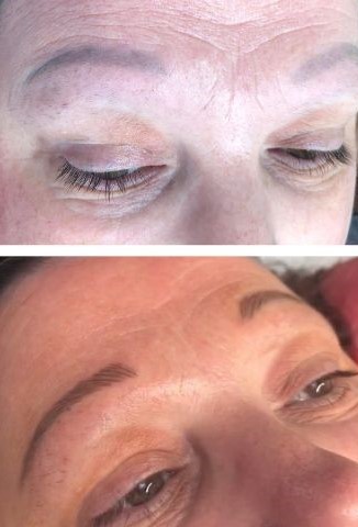 Before and after photos of a woman who has permanent make-up in the form of microblading at Shamrock Clinic in Lower Stondon, Bedfordshire