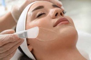 Applying Chemical Peel