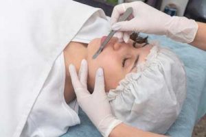 Dermaplaning in Lower Stondon, Bedfordshire