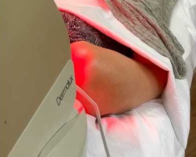 LED Facials at Shamrock Clinic Bedfordshire